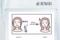 劃重點~瘦臉必看知識