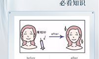 劃重點~瘦臉必看知識