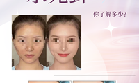 令人心動又有點怕怕的水光針你了解多少