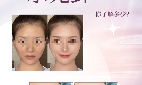 令人心動又有點怕怕的水光針你了解多少
