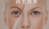 神奇的PRP再生技術！